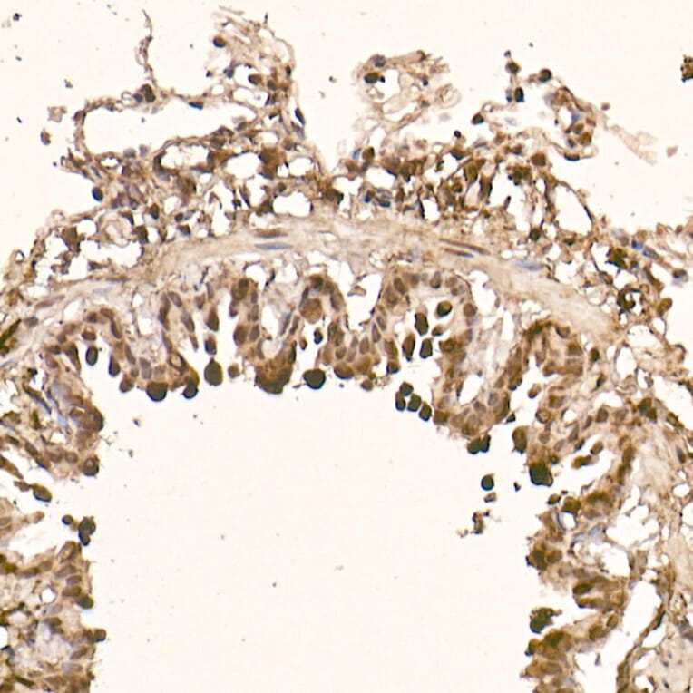 Immunohistochemistry - Anti-AKT1 Antibody [ARC51585] (A308667) - Antibodies.com