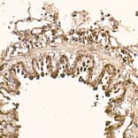 Immunohistochemistry - Anti-AKT1 Antibody [ARC51585] (A308667) - Antibodies.com