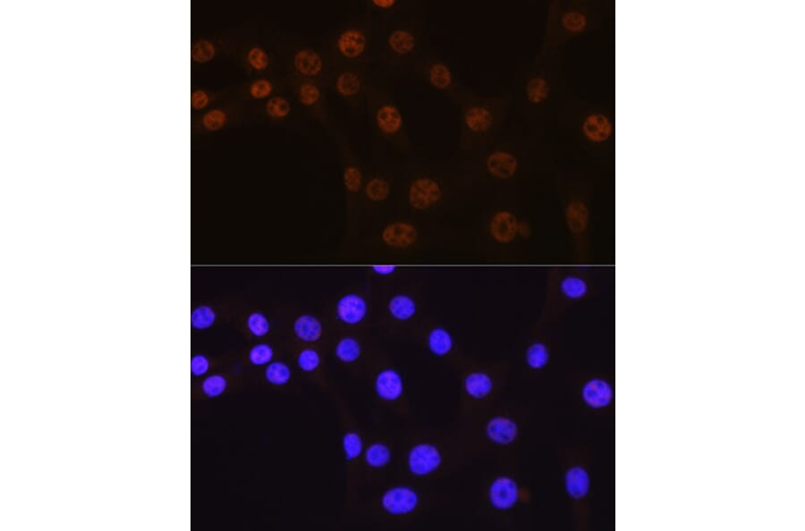 Immunofluorescence - Anti-AKT1 Antibody [ARC51585] (A308667) - Antibodies.com