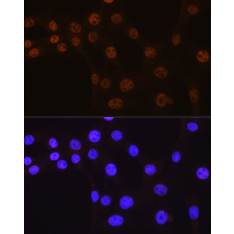 Immunofluorescence - Anti-AKT1 Antibody [ARC51585] (A308667) - Antibodies.com