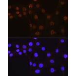 Immunofluorescence - Anti-AKT1 Antibody [ARC51585] (A308667) - Antibodies.com