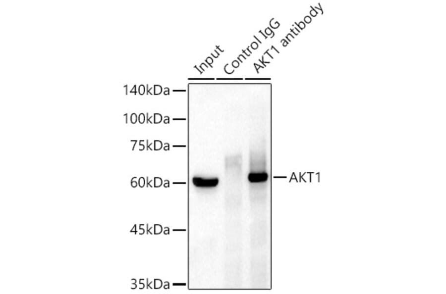 Western Blot - Anti-AKT1 Antibody [ARC51585] (A308667) - Antibodies.com