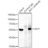 Western Blot - Anti-AKT1 Antibody [ARC51585] (A308667) - Antibodies.com