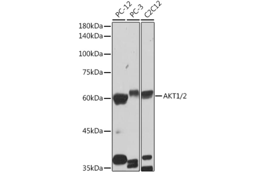 Western Blot - Anti-AKT1 +AKT2 Antibody [ARC2651] (A308668) - Antibodies.com