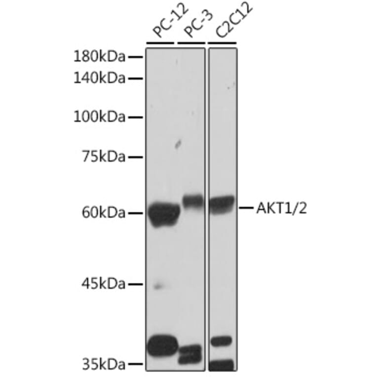 Western Blot - Anti-AKT1 +AKT2 Antibody [ARC2651] (A308668) - Antibodies.com