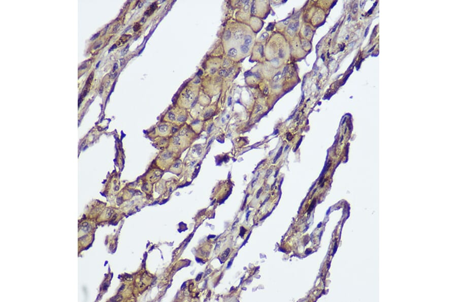 Immunohistochemistry - Anti-AKT1 +AKT2 Antibody [ARC2651] (A308668) - Antibodies.com