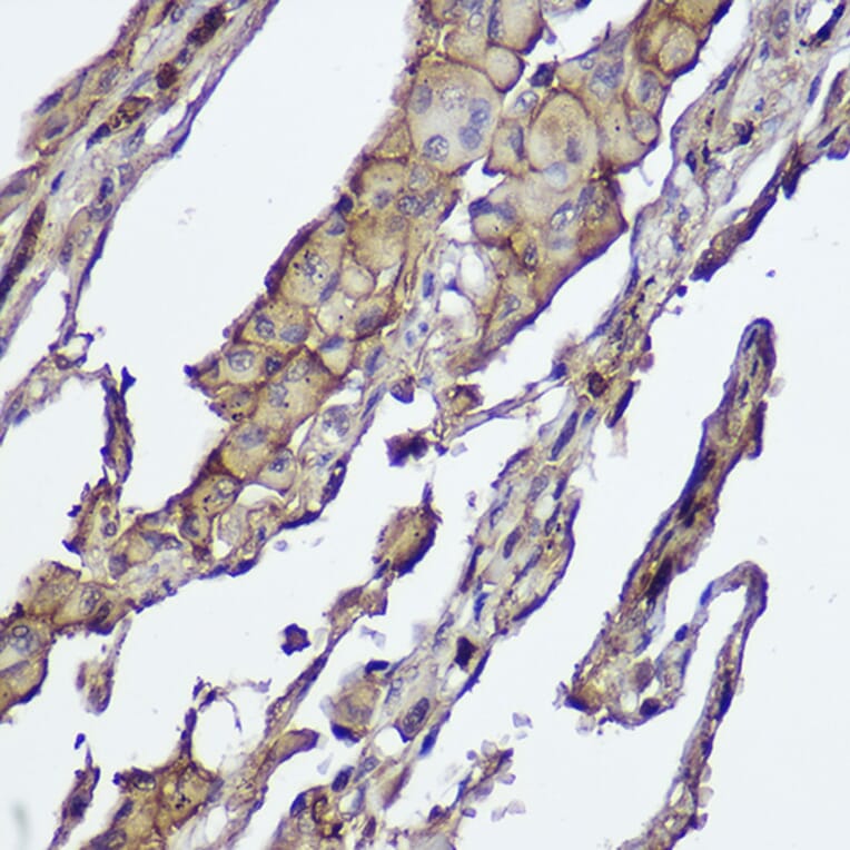 Immunohistochemistry - Anti-AKT1 +AKT2 Antibody [ARC2651] (A308668) - Antibodies.com
