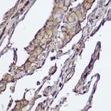 Immunohistochemistry - Anti-AKT1 +AKT2 Antibody [ARC2651] (A308668) - Antibodies.com