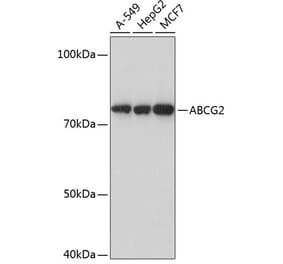 Western Blot - Anti-BCRP/ABCG2 Antibody [ARC0383] (A308669) - Antibodies.com