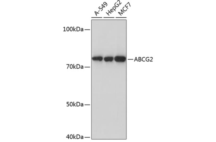 Western Blot - Anti-BCRP/ABCG2 Antibody [ARC0383] (A308669) - Antibodies.com