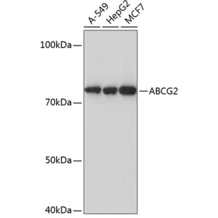 Western Blot - Anti-BCRP/ABCG2 Antibody [ARC0383] (A308669) - Antibodies.com