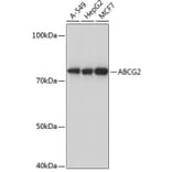 Western Blot - Anti-BCRP/ABCG2 Antibody [ARC0383] (A308669) - Antibodies.com