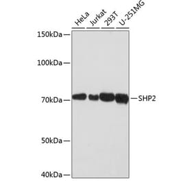 Western Blot - Anti-SHP2 Antibody [ARC0356] (A308672) - Antibodies.com