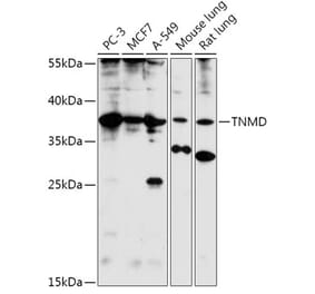 Western Blot - Anti-Tenomodulin Antibody (A308673) - Antibodies.com