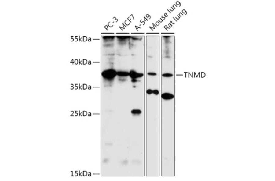 Western Blot - Anti-Tenomodulin Antibody (A308673) - Antibodies.com