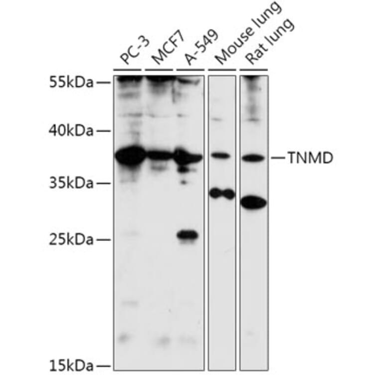Western Blot - Anti-Tenomodulin Antibody (A308673) - Antibodies.com