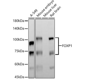 Western Blot - Anti-FOXP1 Antibody [ARC1624] (A308674) - Antibodies.com