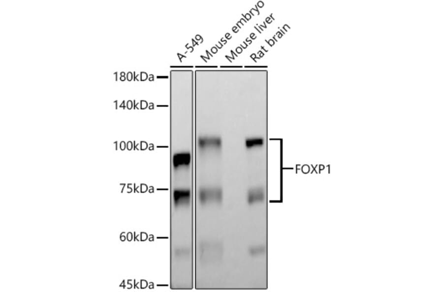 Western Blot - Anti-FOXP1 Antibody [ARC1624] (A308674) - Antibodies.com