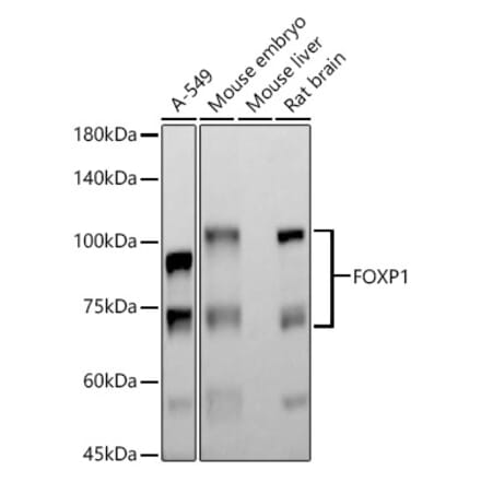 Western Blot - Anti-FOXP1 Antibody [ARC1624] (A308674) - Antibodies.com