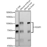 Western Blot - Anti-FOXP1 Antibody [ARC1624] (A308674) - Antibodies.com