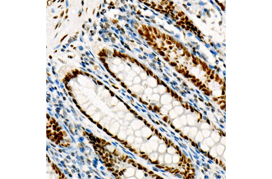 Immunohistochemistry - Anti-FOXP1 Antibody [ARC1624] (A308674) - Antibodies.com