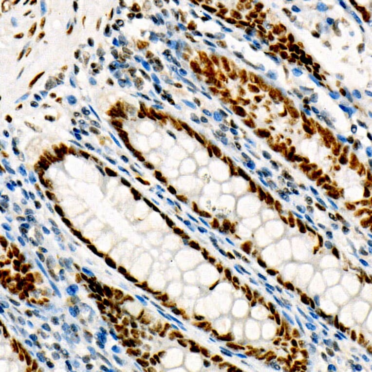 Immunohistochemistry - Anti-FOXP1 Antibody [ARC1624] (A308674) - Antibodies.com