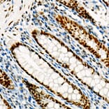 Immunohistochemistry - Anti-FOXP1 Antibody [ARC1624] (A308674) - Antibodies.com
