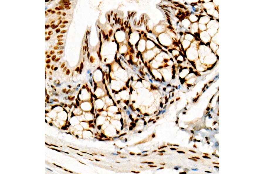 Immunohistochemistry - Anti-FOXP1 Antibody [ARC1624] (A308674) - Antibodies.com