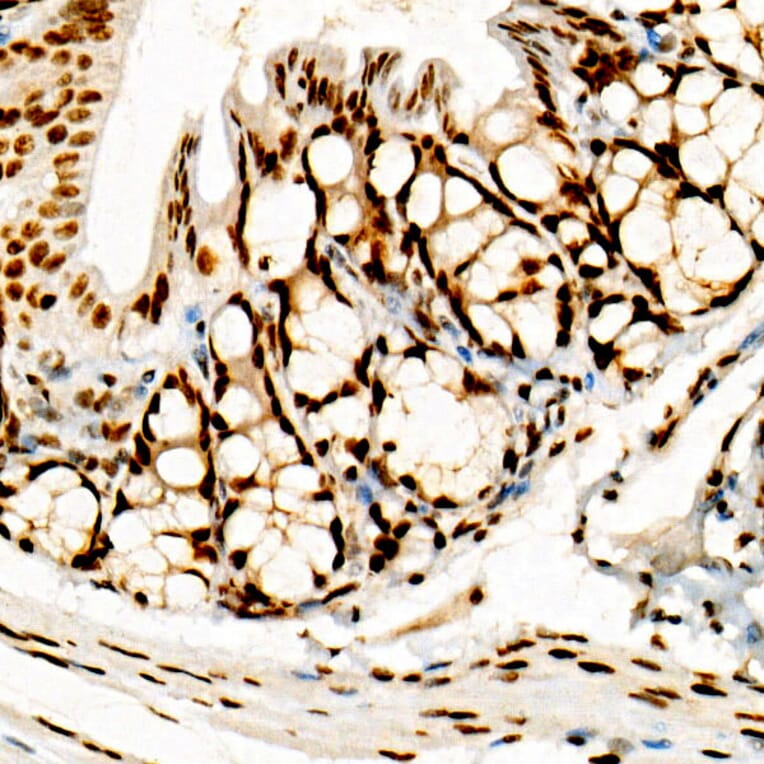 Immunohistochemistry - Anti-FOXP1 Antibody [ARC1624] (A308674) - Antibodies.com