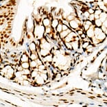 Immunohistochemistry - Anti-FOXP1 Antibody [ARC1624] (A308674) - Antibodies.com