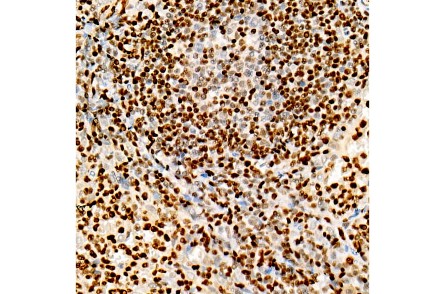 Immunohistochemistry - Anti-FOXP1 Antibody [ARC1624] (A308674) - Antibodies.com