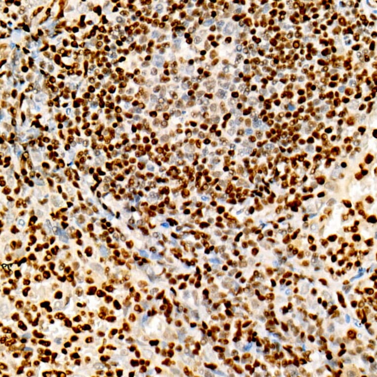 Immunohistochemistry - Anti-FOXP1 Antibody [ARC1624] (A308674) - Antibodies.com
