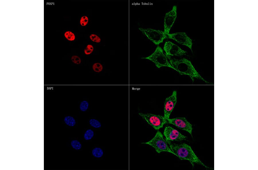 Immunofluorescence - Anti-FOXP1 Antibody [ARC1624] (A308674) - Antibodies.com