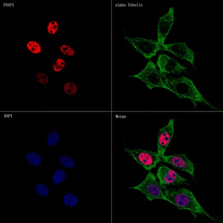 Immunofluorescence - Anti-FOXP1 Antibody [ARC1624] (A308674) - Antibodies.com
