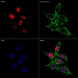 Immunofluorescence - Anti-FOXP1 Antibody [ARC1624] (A308674) - Antibodies.com