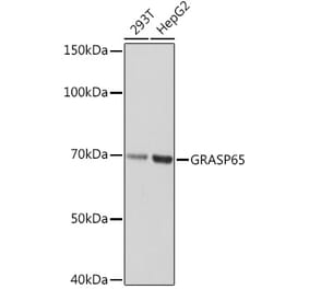 Western Blot - Anti-GRASP65 Antibody [ARC1911] (A308675) - Antibodies.com