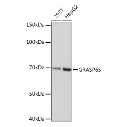 Western Blot - Anti-GRASP65 Antibody [ARC1911] (A308675) - Antibodies.com