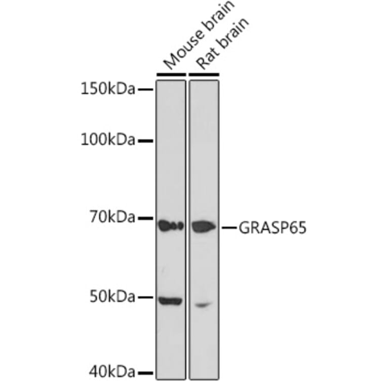 Western Blot - Anti-GRASP65 Antibody [ARC1911] (A308675) - Antibodies.com