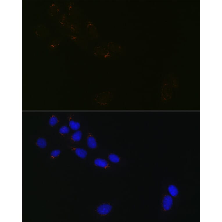 Immunofluorescence - Anti-GRASP65 Antibody [ARC1911] (A308675) - Antibodies.com