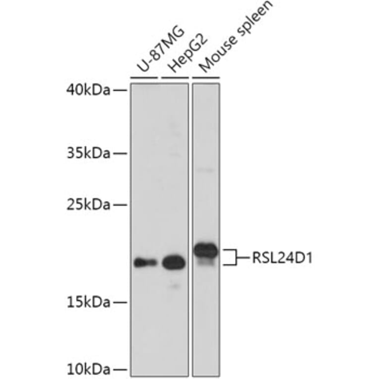 Western Blot - Anti-RSL24D1 Antibody (A308676) - Antibodies.com
