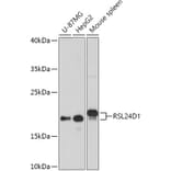 Western Blot - Anti-RSL24D1 Antibody (A308676) - Antibodies.com