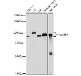 Western Blot - Anti-RanBP9 Antibody [ARC2397] (A308677) - Antibodies.com