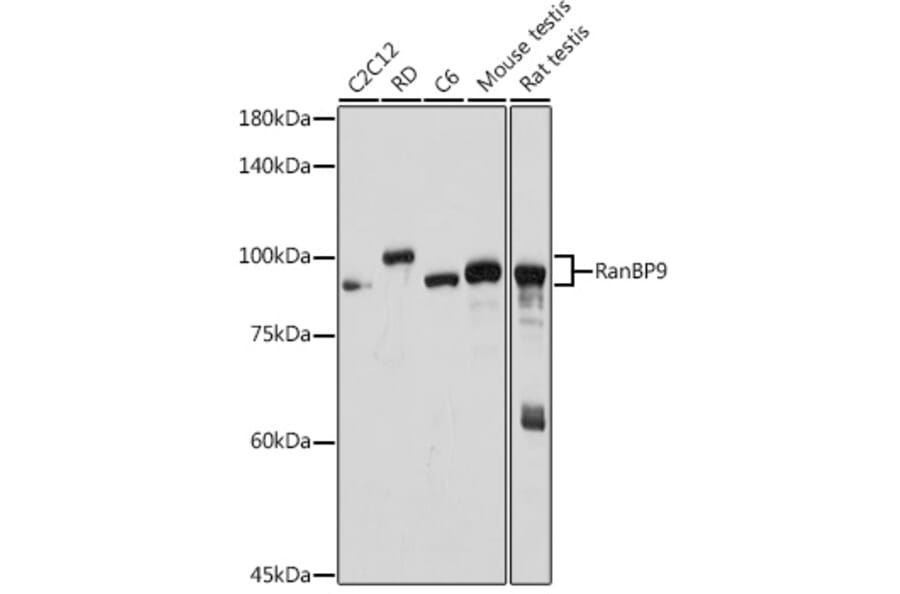 Western Blot - Anti-RanBP9 Antibody [ARC2397] (A308677) - Antibodies.com