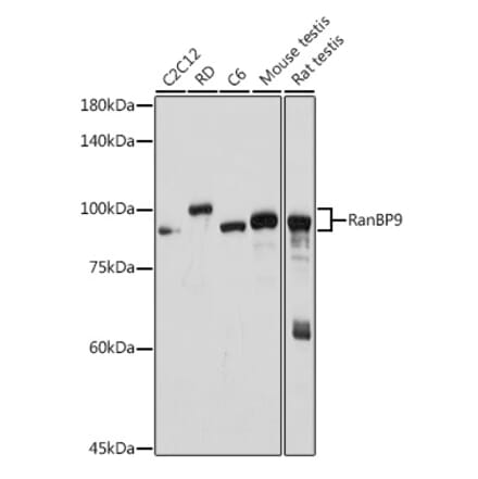 Western Blot - Anti-RanBP9 Antibody [ARC2397] (A308677) - Antibodies.com