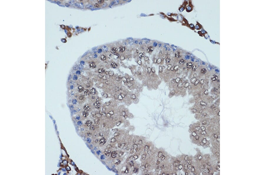 Immunohistochemistry - Anti-RanBP9 Antibody [ARC2397] (A308677) - Antibodies.com
