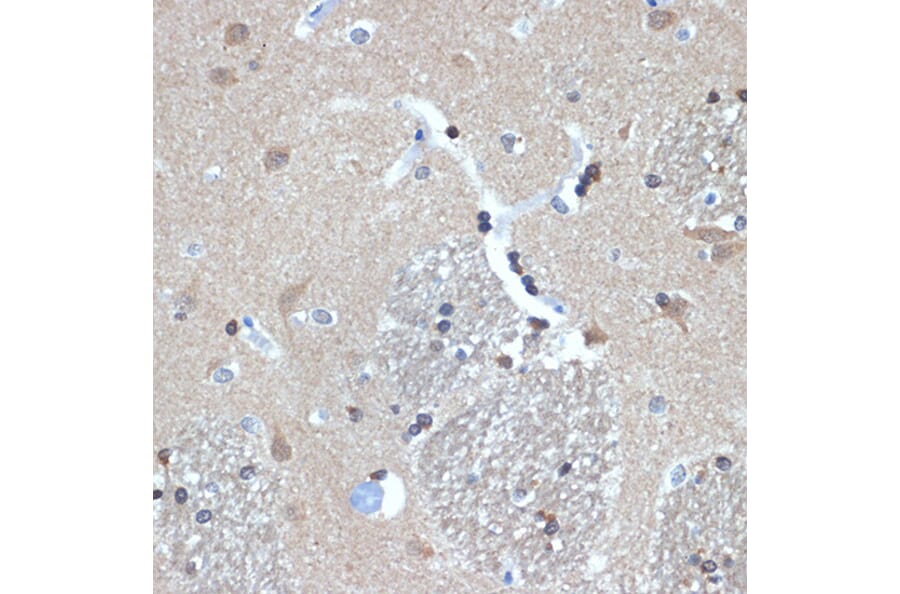 Immunohistochemistry - Anti-RanBP9 Antibody [ARC2397] (A308677) - Antibodies.com
