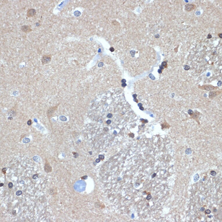 Immunohistochemistry - Anti-RanBP9 Antibody [ARC2397] (A308677) - Antibodies.com