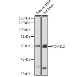 Western Blot - Anti-TOM1L2 Antibody (A308678) - Antibodies.com