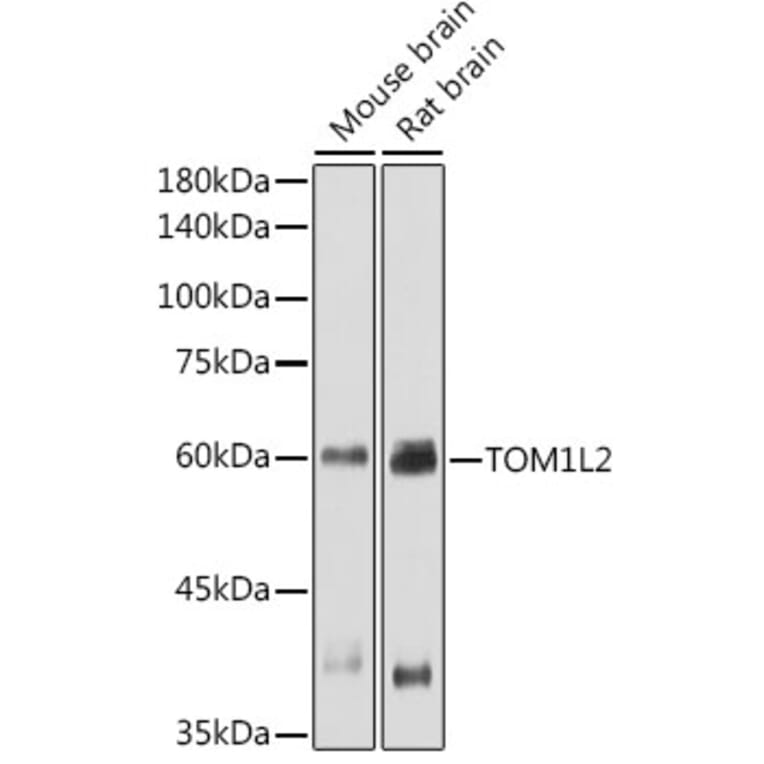 Western Blot - Anti-TOM1L2 Antibody (A308678) - Antibodies.com