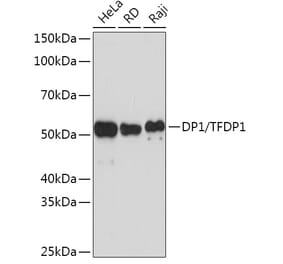 Western Blot - Anti-DP1 Antibody [ARC1202] (A308679) - Antibodies.com